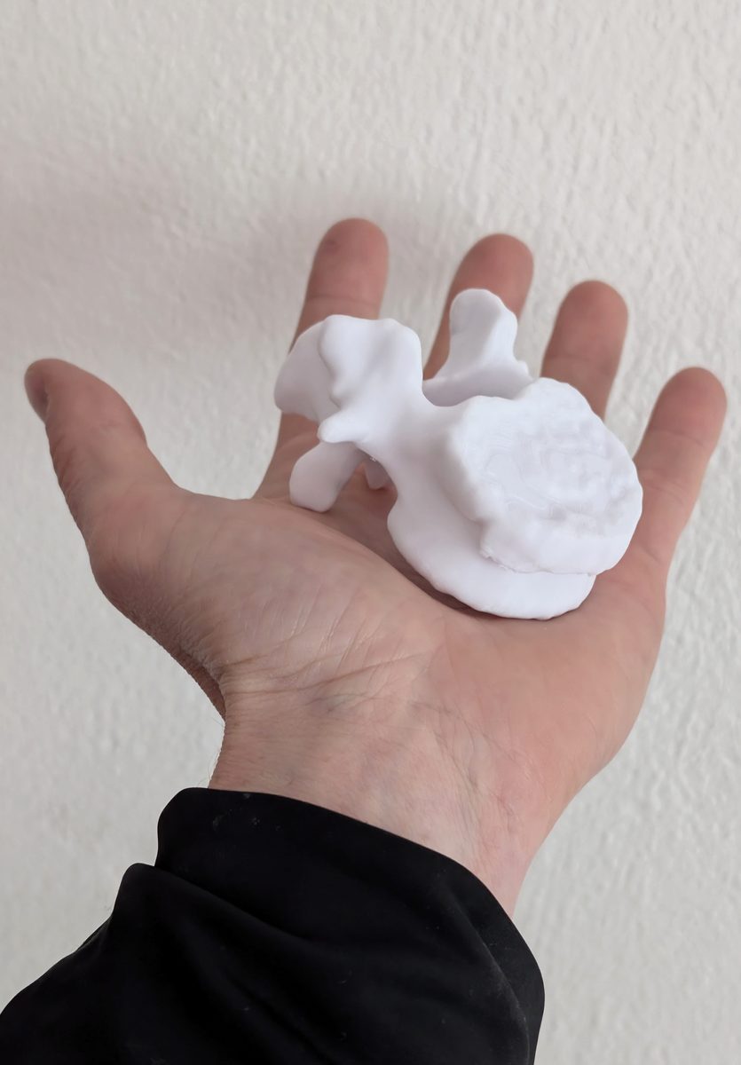 LWK 1 Wirbel in der Hand